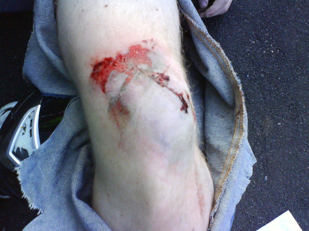 093.thumb.JPG.a9e8f844c7d028fcb7957cc308c38ffe.JPG